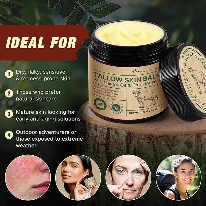 Beef Tallow Skin Care with Castor Oi & Frankincenses, Grass Fed Whipped Tallow Honey Balm for Face & Body, Natural Moisturizer Hydrates, Deeply Nourishes, Enhances Natural Radiance