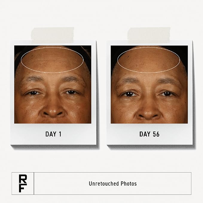 RODAN + FIELDS Redefine Overnight Restorative Cream | Step 3 PM | Anti Aging Face Moisturizer for Deep Wrinkles & Fine Lines | Firms & Tightens Skin | Night Face Cream | Glycolic Acid & Bakuchiol