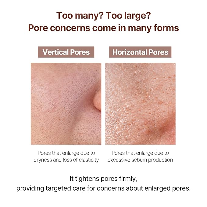 AVCA Retinol Pore Tightening Serum 100ml(3.38 fl. oz)– Niacinamide Oil Control, Minimizes the Look of Pores for Oily/Combination Skin, Lightweight K-Beauty