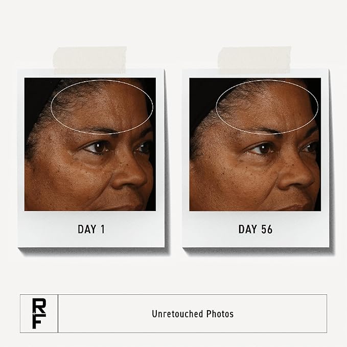 RODAN + FIELDS Redefine Overnight Restorative Cream | Step 3 PM | Anti Aging Face Moisturizer for Deep Wrinkles & Fine Lines | Firms & Tightens Skin | Night Face Cream | Glycolic Acid & Bakuchiol